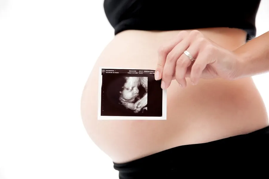 Ultrazvukový snímek položený na těhotenském bříšku
